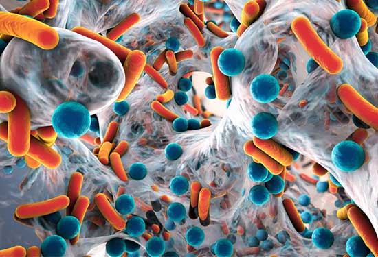 sonotix-biofilm-gesellschaft
